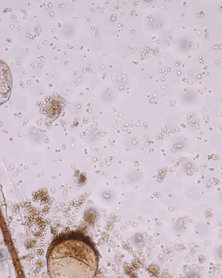 Microscopic view of a pale pinkish liquid or slide containing numerous small clear circular bodies and scattered golden-brown granular clusters, with part of a larger round object visible at the lower left.